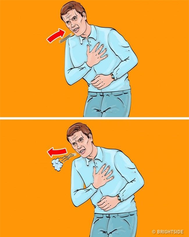 nhung ky nang cuu nguoi don gian nhung ai cung can phai biet - 2