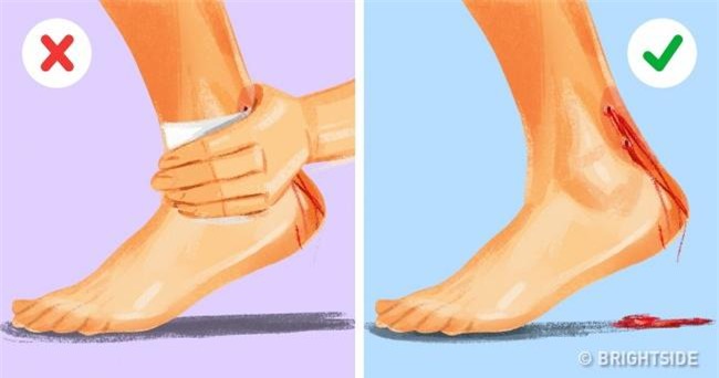 nhung ky nang cuu nguoi don gian nhung ai cung can phai biet - 4