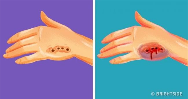 nhung ky nang cuu nguoi don gian nhung ai cung can phai biet - 5