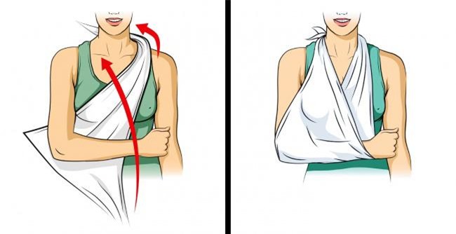 nhung ky nang cuu nguoi don gian nhung ai cung can phai biet - 6