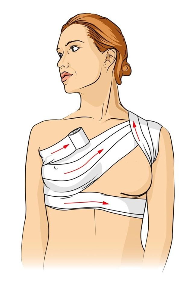 nhung ky nang cuu nguoi don gian nhung ai cung can phai biet - 8