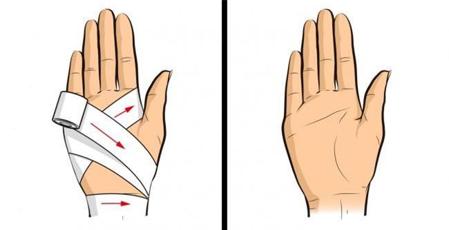 nhung ky nang cuu nguoi don gian nhung ai cung can phai biet - 9