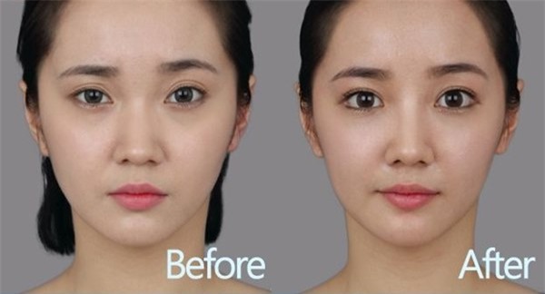 rung ron voi nhung ca lam mui hong, loi sun gia hinh anh 7