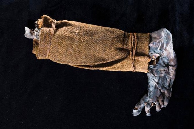 kinh ngac voi 9 xac uop “sieu thuc” nhat the gioi - 5