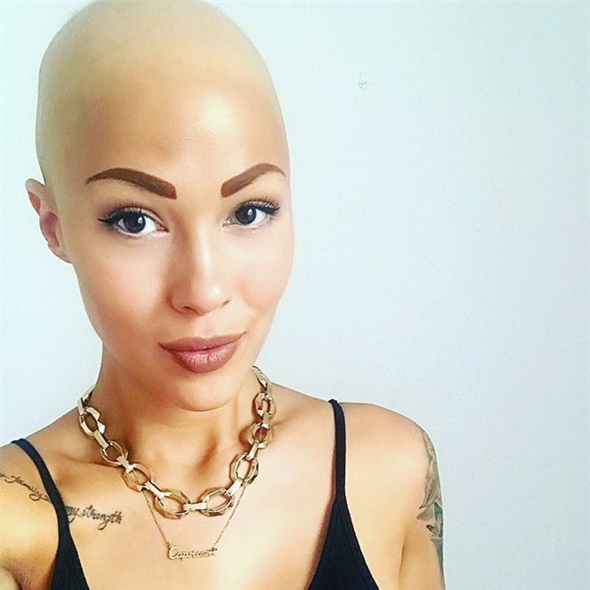 Tưởng mình bị ung thư khi tóc rụng dần, 12 năm sau, cô trở thành một người mẫu xinh đẹp với chiếc đầu trọc lóc - Ảnh 4.