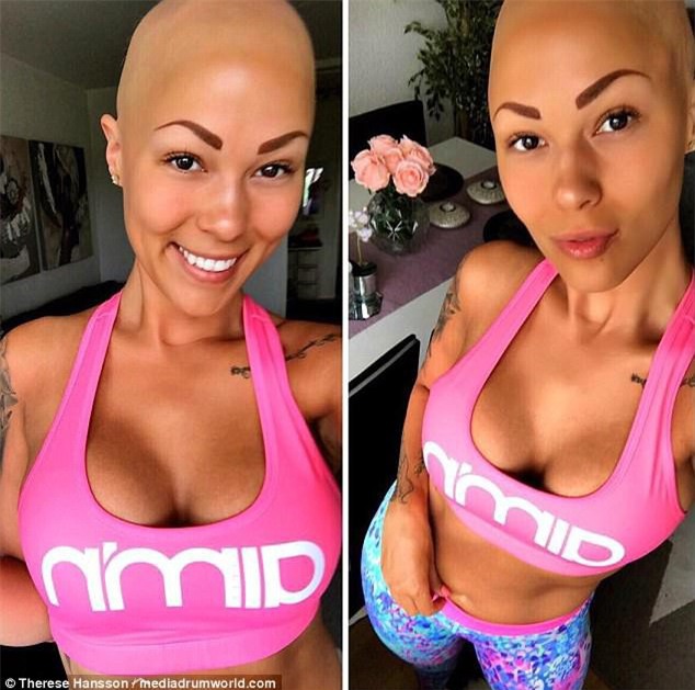 Tưởng mình bị ung thư khi tóc rụng dần, 12 năm sau, cô trở thành một người mẫu xinh đẹp với chiếc đầu trọc lóc - Ảnh 5.