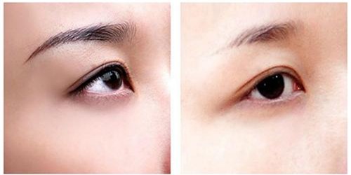 nhung cong dung lam dep day bat ngo cua hanh chi em can bo tui ngay! - 5