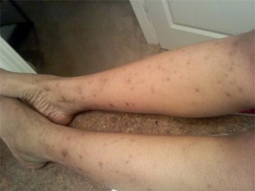 nhung cong dung lam dep day bat ngo cua hanh chi em can bo tui ngay! - 8