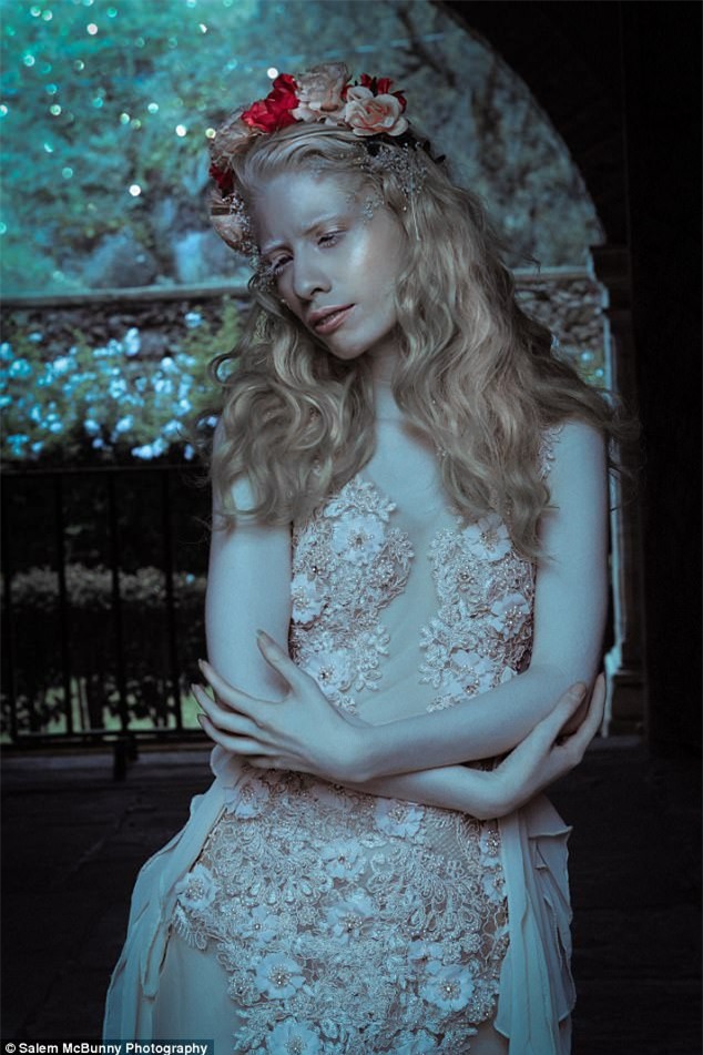 Từng bị cho là ma quỷ, cô gái này đã trả đũa những kẻ chế giễu mình bằng cách đầy thuyết phục - Ảnh 4.