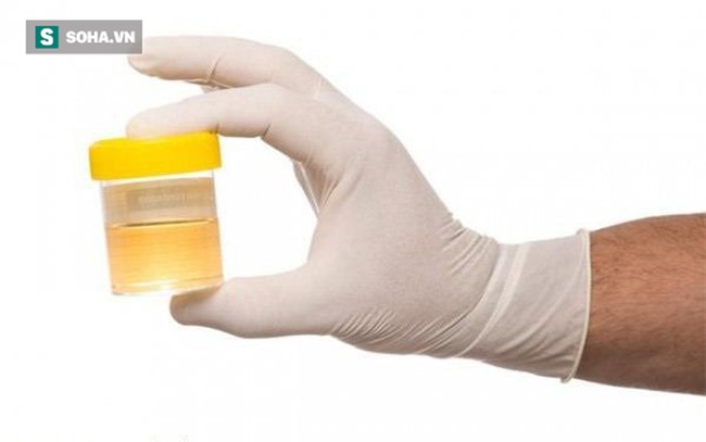 Khi đi tiểu thấy dấu hiệu bất thường này có thể là tín hiệu ung thư-2