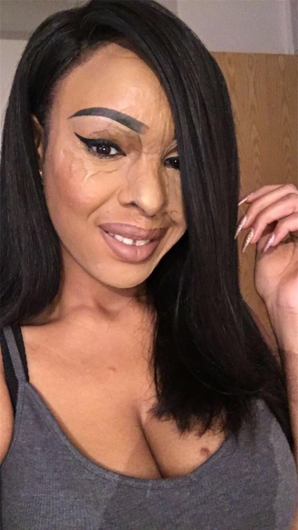 Ghen tị vì bạn thân đẹp hơn mình, cô gái nhẫn tâm dùng axit hủy hoại dung nhan bạn để trả thù - Ảnh 4.