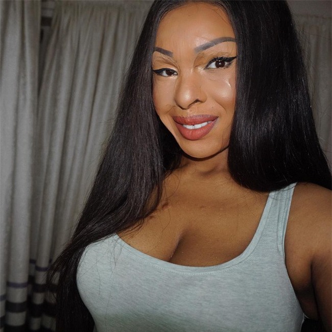 Ghen tị vì bạn thân đẹp hơn mình, cô gái nhẫn tâm dùng axit hủy hoại dung nhan bạn để trả thù - Ảnh 5.