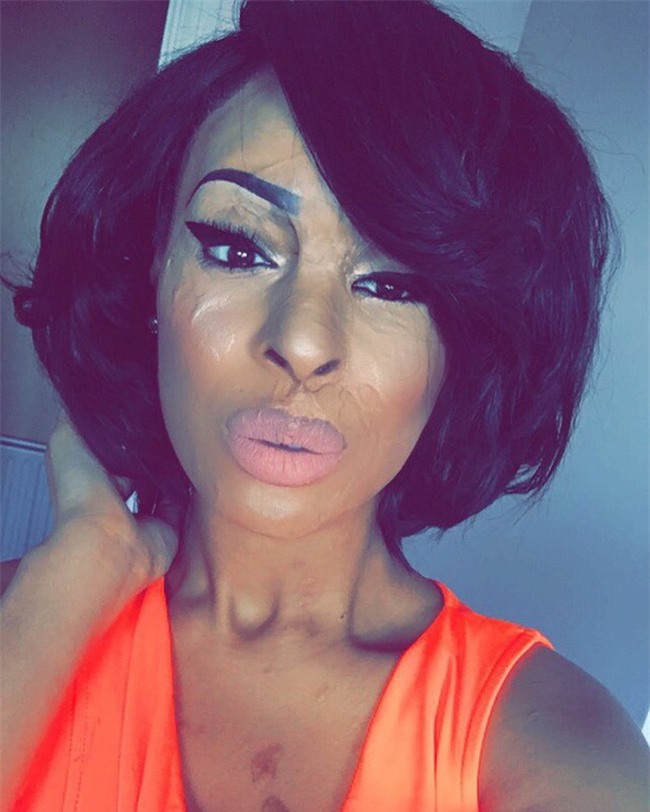 Ghen tị vì bạn thân đẹp hơn mình, cô gái nhẫn tâm dùng axit hủy hoại dung nhan bạn để trả thù - Ảnh 6.