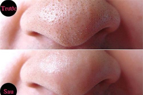 top 10 chu de lam dep duoc chi em phu nu quan tam nhat 2017 vua qua - 13