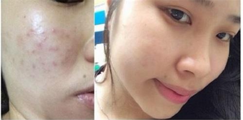 top 10 chu de lam dep duoc chi em phu nu quan tam nhat 2017 vua qua - 14