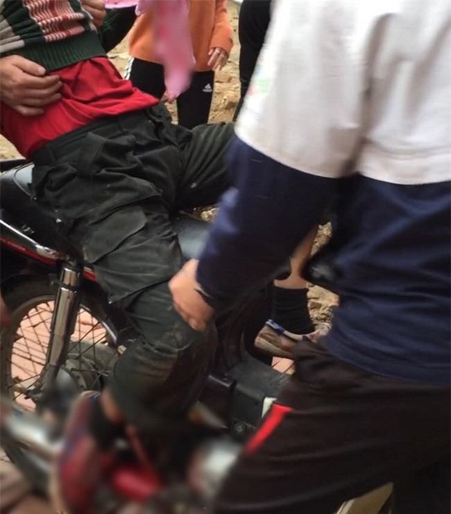 Người đàn ông bị nổ nát bàn tay khi nhặt vỏ đạn sau vụ nổ kinh hoàng ở Bắc Ninh - Ảnh 1.