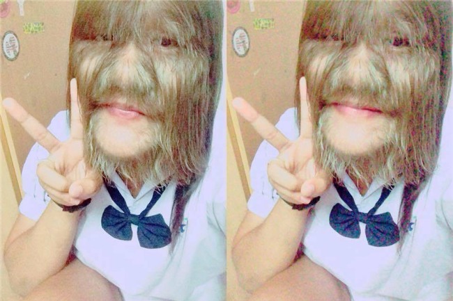 Thái Lan: Cô gái 17 tuổi giữ kỷ lục nhiều lông nhất thế giới khiến mọi người kinh ngạc khi cạo sạch lông mặt! - Ảnh 2.