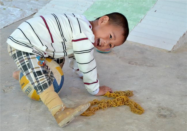 Thai nhi kỳ diệu ở An Giang bây giờ ra sao?