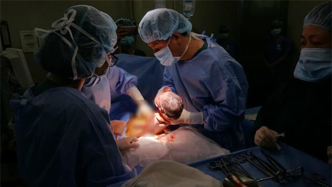 tp.hcm: phep mau ky dieu den voi be gai vua chao doi co ruot, gan o ngoai thanh bung - 1