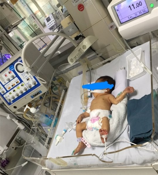 Bé gái 32 tuần tuổi bị mẹ phá thai để chối bỏ được nhóm thiện nguyện khi đi nhặt xác thai nhi cứu sống - Ảnh 3.