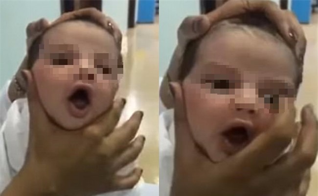 Hình ảnh gây phẫn nộ: Nữ y tá vặn bóp, đè lún đầu trẻ sơ sinh trong bệnh viện - Ảnh 1.