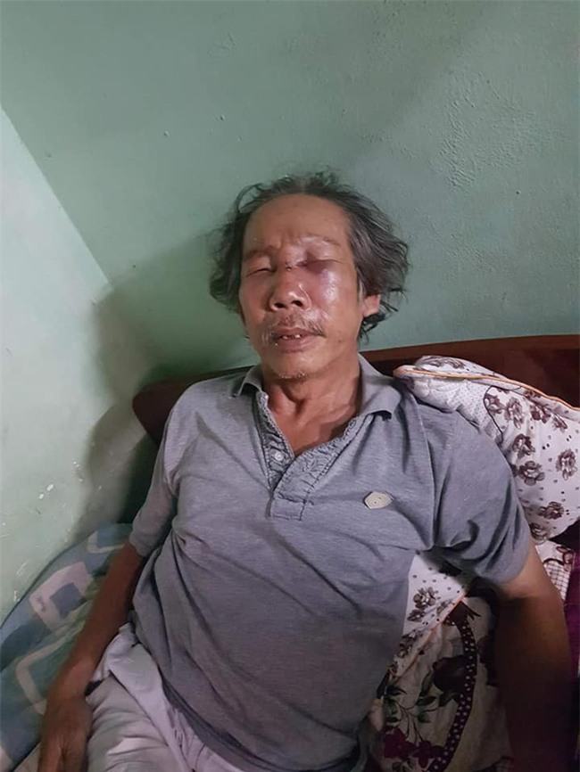 Clip phẫn nộ: Đến thăm con, cụ ông bị bảo vệ chung cư ở Sài Gòn đánh dã man đến gãy sống mũi - Ảnh 2.