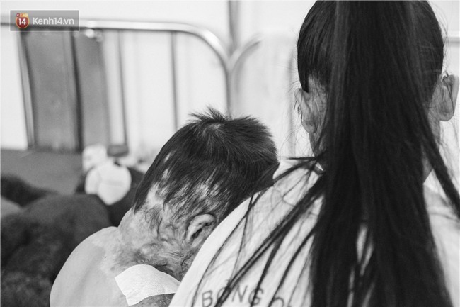 Xót xa những vết bỏng đau đớn trên người bé trai 6 tuổi: Ngày con phải cưa chân là ngày bạn bè vào lớp 1 - Ảnh 6.