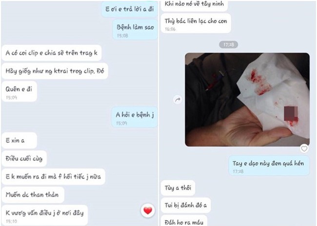 Cô nàng giở chiêu giả mắc bệnh nan y, sắp ra đi để chia tay bạn trai, hẹn hò người mới - Ảnh 4.