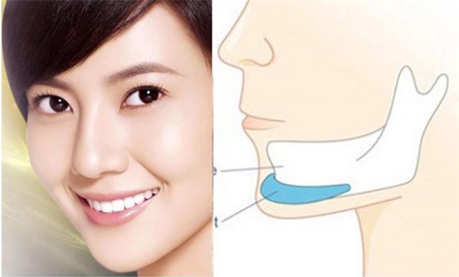 quyet dinh got cam, ban rat co kha nang chiu mot trong nhung bien chung nguy hai khon luong nay! - 1