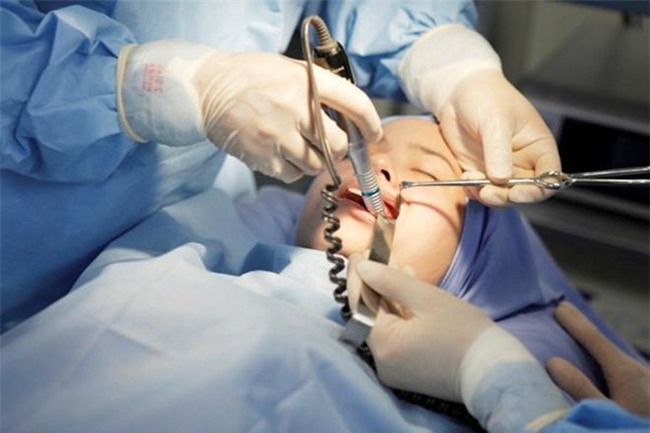 quyet dinh got cam, ban rat co kha nang chiu mot trong nhung bien chung nguy hai khon luong nay! - 2