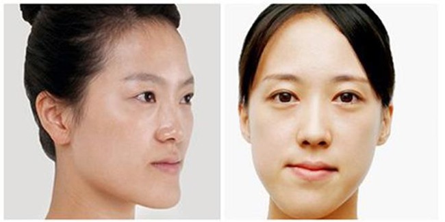 quyet dinh got cam, ban rat co kha nang chiu mot trong nhung bien chung nguy hai khon luong nay! - 7