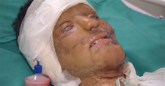 Từ chối lời cầu hôn của bạn trai, cô gái bị tạt axit đến biến dạng khuôn mặt, 14 năm sau phép màu lại xuất hiện - Ảnh 3.