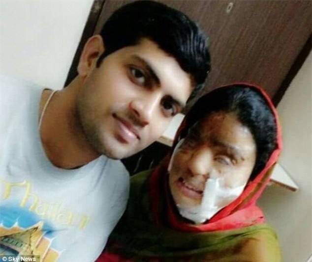 Từ chối lời cầu hôn của bạn trai, cô gái bị tạt axit đến biến dạng khuôn mặt, 14 năm sau phép màu lại xuất hiện - Ảnh 7.