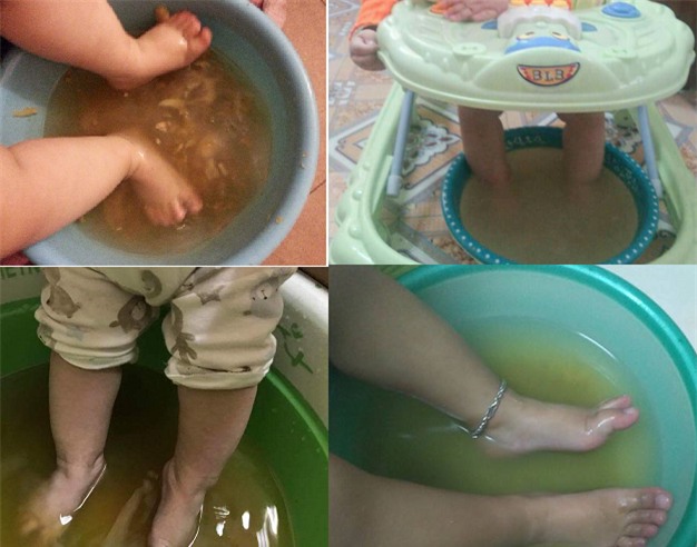 Tin tưởng bài thuốc dân gian truyền miệng, con trẻ gặp nguy hiểm-1