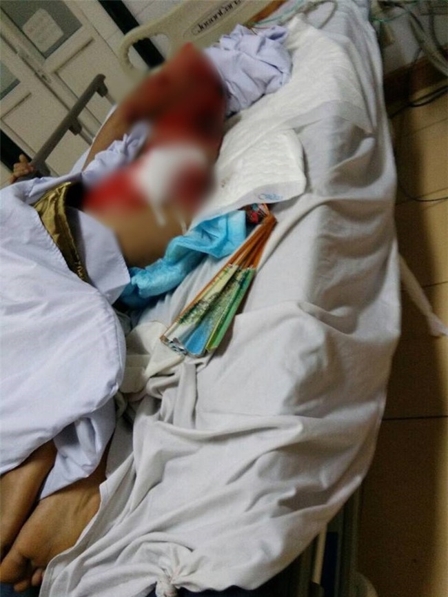 Clip gây phẫn nộ: Chặn bắt tên trộm đánh xe tải đi trộm cây cảnh, người đàn ông bị tông trúng, cán qua người trọng thương