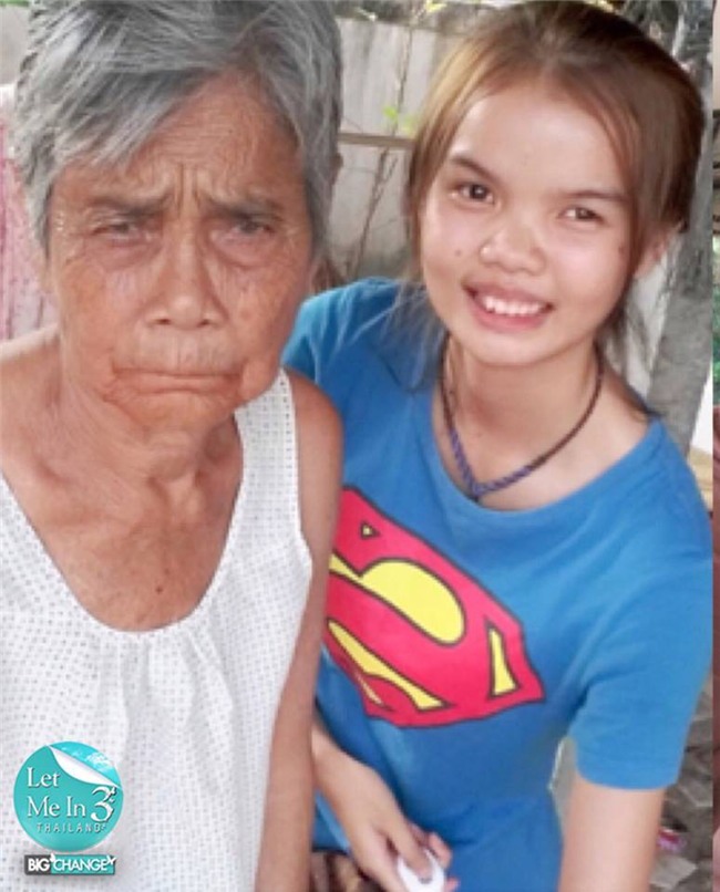 Phẫu thuật thẩm mỹ giống búp bê Barbie, nữ sinh Thái Lan bị cư dân mạng chỉ trích vì gương mặt quái dị - Ảnh 1.