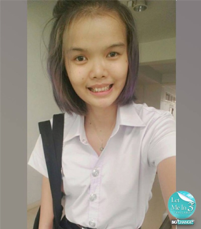 Phẫu thuật thẩm mỹ giống búp bê Barbie, nữ sinh Thái Lan bị cư dân mạng chỉ trích vì gương mặt quái dị - Ảnh 2.