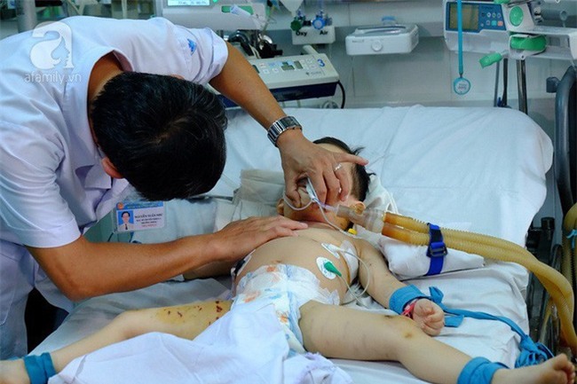 Mẹ lo làm việc dưới bếp, con trai bị chó nhà cắn thủng khí quản - Ảnh 7.