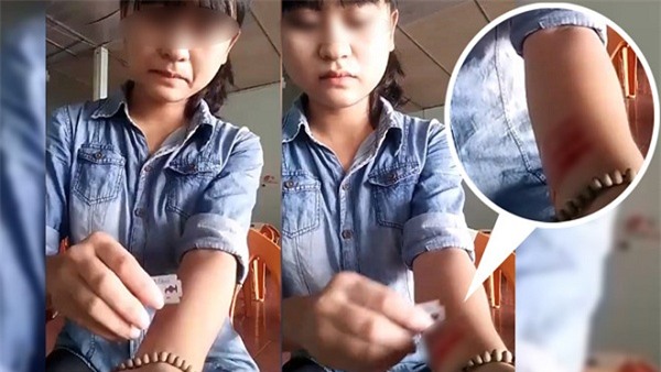 Tự hủy hoại bản thân là cách để vượt qua khủng hoảng nhất thời