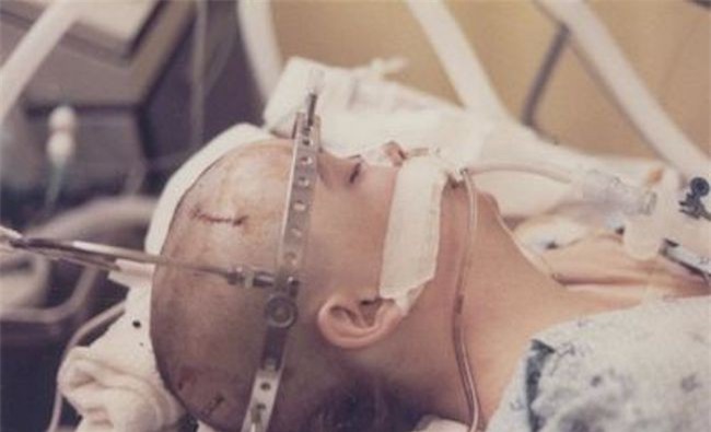 20 năm chìm trong hôn mê, đến khi tỉnh dậy, cô gái nói cho gia đình nghe một sự thật khiến y học kinh ngạc - Ảnh 2.