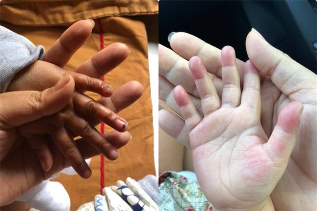 Vợ chồng ở Sài Gòn hoãn mua ô tô, vượt nghìn km đến Mường Lát nhận nuôi bé gái liệt 2 chân không manh áo giữa mùa đông - Ảnh 9.