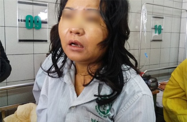 Một phụ nữ nguy kịch, xơ gan nghi do sử dụng thực phẩm chức năng để giảm cân - Ảnh 3.