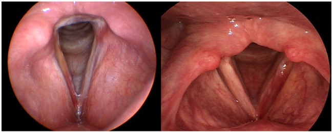 Căn bệnh tương tự Adele mà Mỹ Tâm đang mắc phải là bệnh gì? - Ảnh 3.