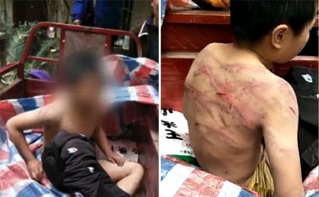 Bị bố mẹ đánh đập dã man, cậu bé mình chi chít vết roi, cởi trần vạ vật giữa trời âm độ - Ảnh 1.