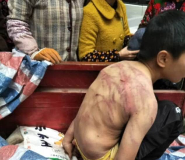 Bị bố mẹ đánh đập dã man, cậu bé mình chi chít vết roi, cởi trần vạ vật giữa trời âm độ - Ảnh 2.