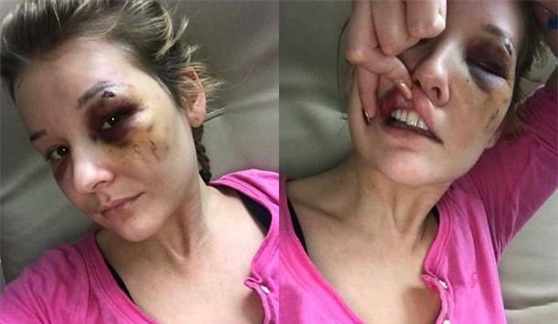 Yêu nhau được 3 tháng, cô gái bị bạn trai đánh đập tàn nhẫn và suýt bán vào động mại dâm - Ảnh 2.