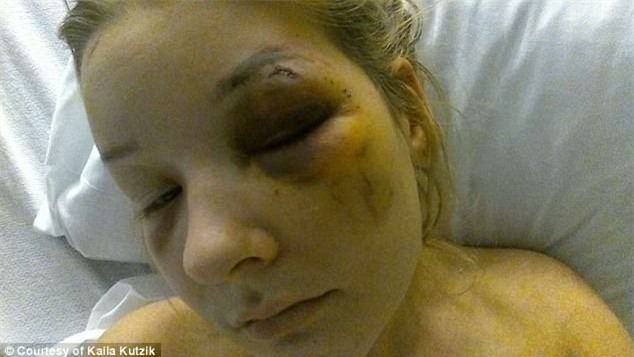 Yêu nhau được 3 tháng, cô gái bị bạn trai đánh đập tàn nhẫn và suýt bán vào động mại dâm - Ảnh 3.