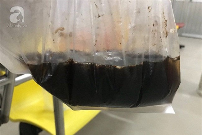 TP.HCM: Ba lần nhập viện bác sĩ mới tìm ra bệnh, sản phụ đau đớn mất con đầu lòng - Ảnh 5.