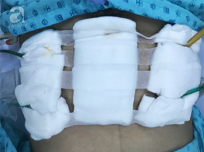 TP.HCM: Ba lần nhập viện bác sĩ mới tìm ra bệnh, sản phụ đau đớn mất con đầu lòng - Ảnh 9.