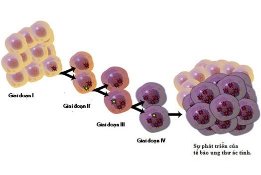 8 quan niệm sai lầm về bệnh ung thư cần từ bỏ ngay-1